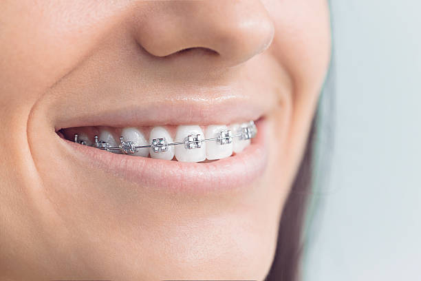 Why Choose Us for Your Dental Needs in Waseca, MN